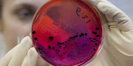 Сибірська виразка : симптоми та профілактика