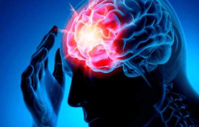 До Всесвітнього дня боротьби з інсультом