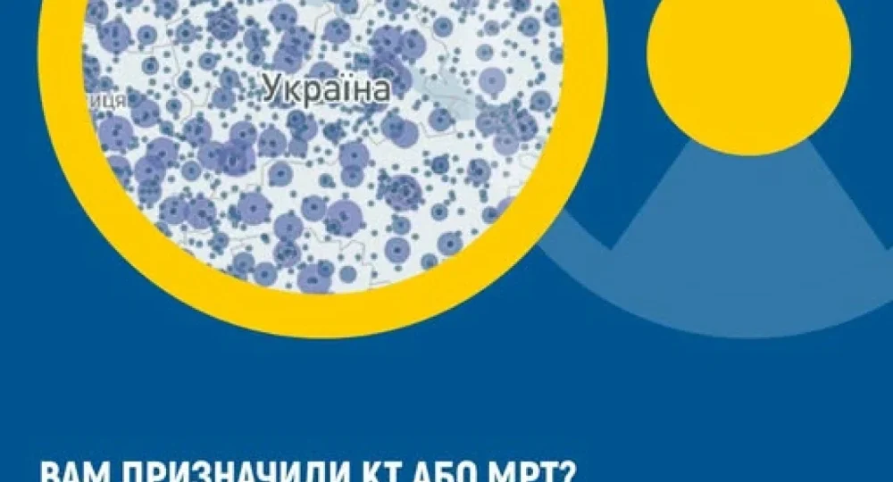 Де шукати інформацію про КТ та МРТ? НСЗУ запустила новий дашборд із даними ЕСОЗ Де шукати інформацію про КТ та МРТ? НСЗУ запустила новий дашборд із даними ЕСОЗ